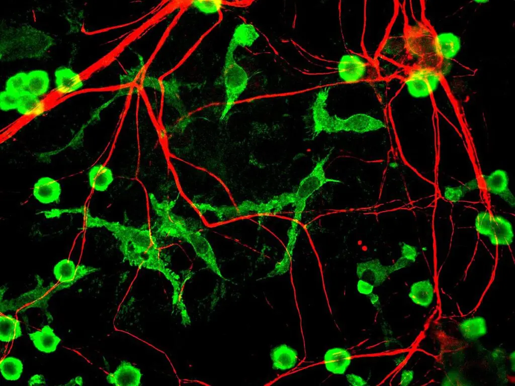 Neurons with red and green highlights in black background