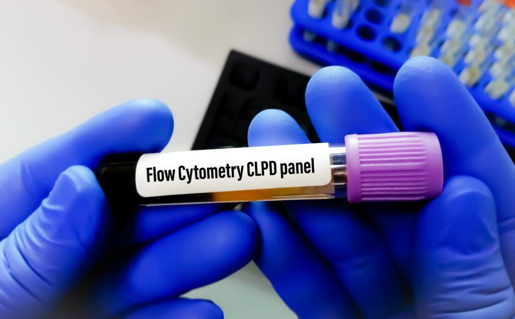 Flow cytometry CLPD panel blood tube.